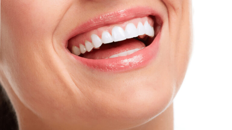 Ayurvedic method to remove yellow stains from teeth