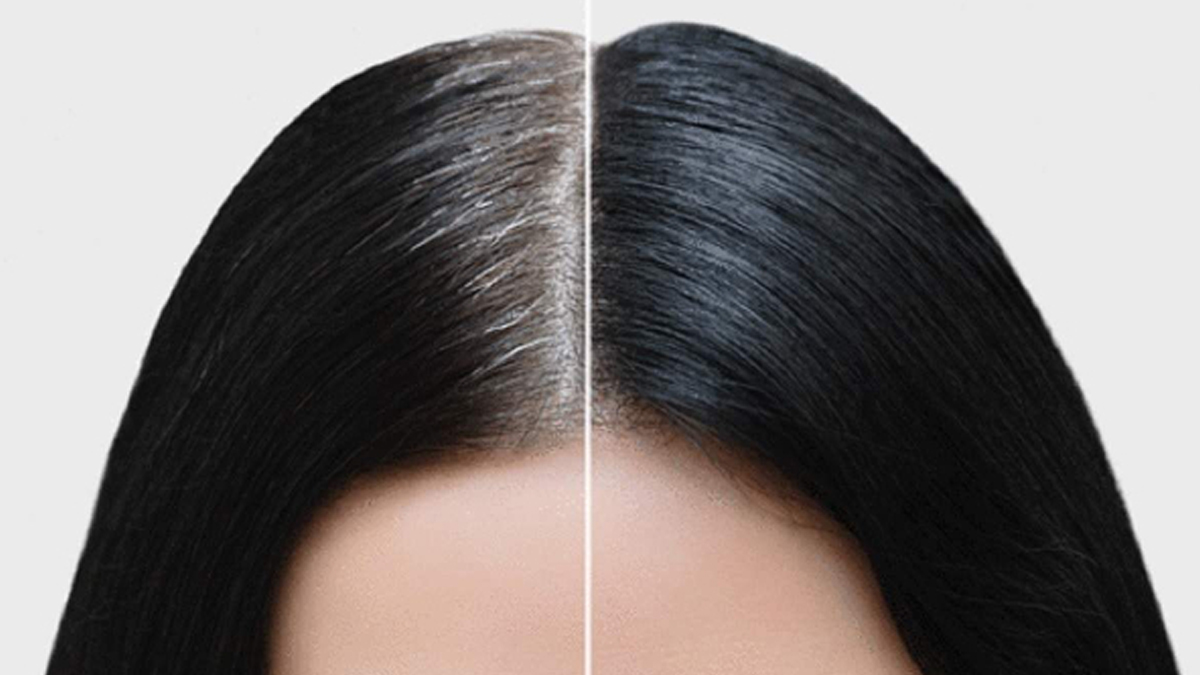 No need to worry about graying of hair the solution is natural