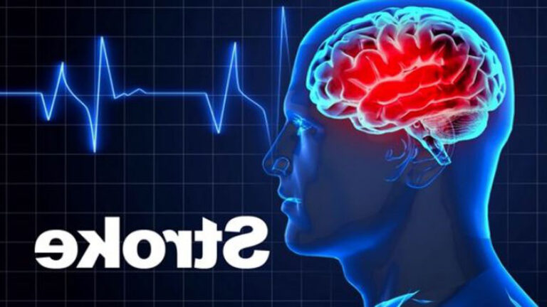 After 10 pm these symptoms may indicate stroke